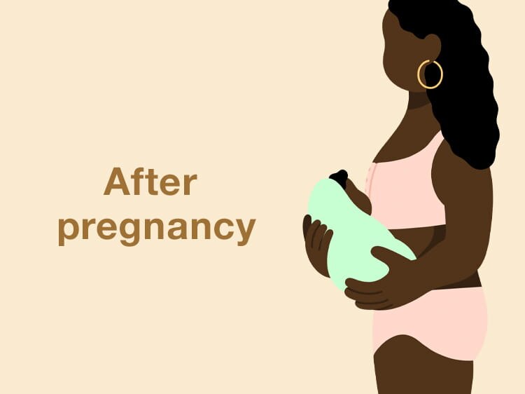After pregnancy